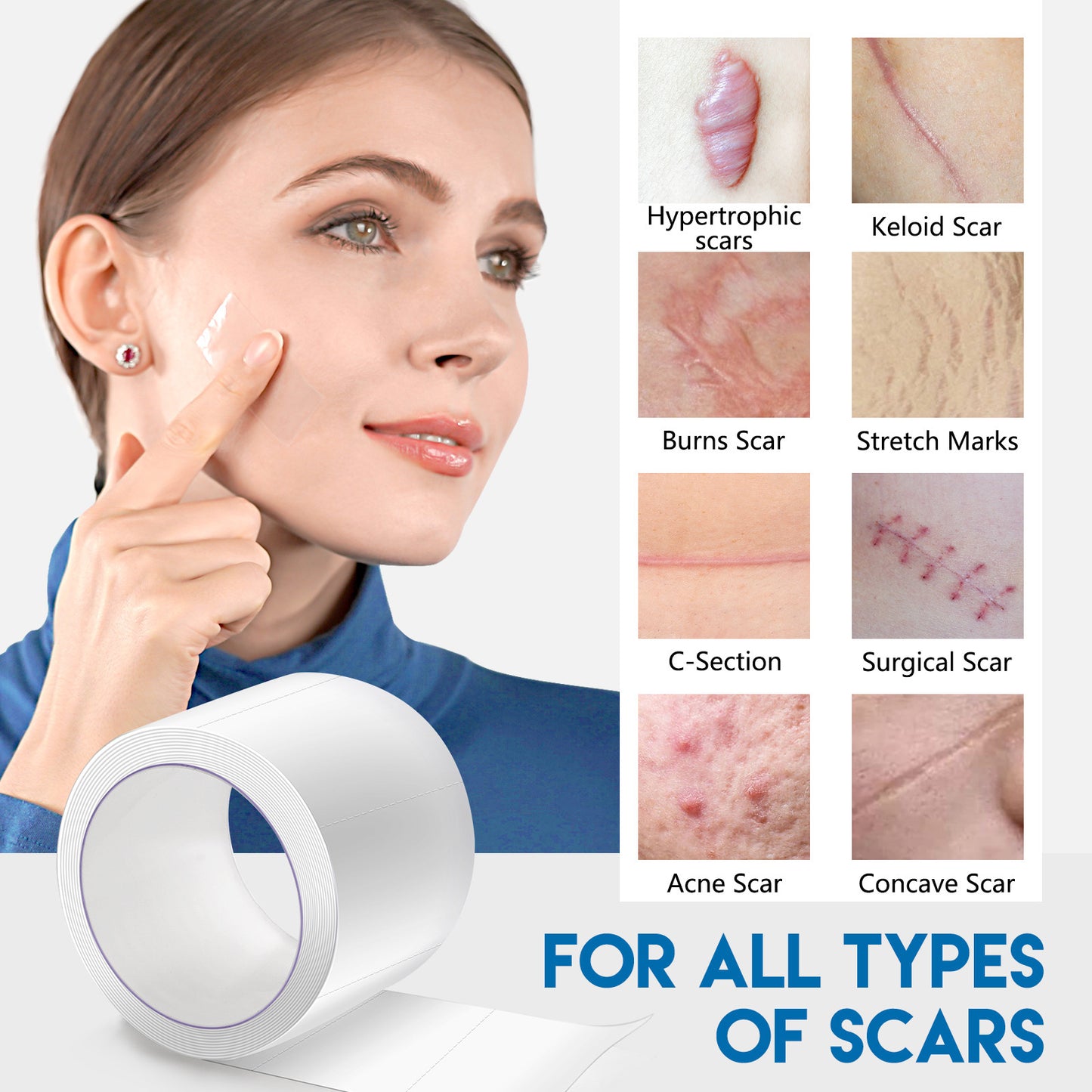ELAIMEI Facial Invisible Scar Sticker Roll Self-adhesive Waterproof Breathable