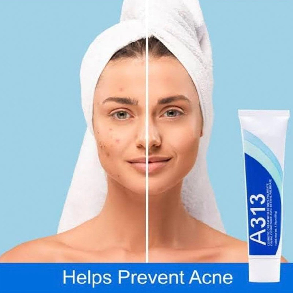 Retinol Vitamin A Cream