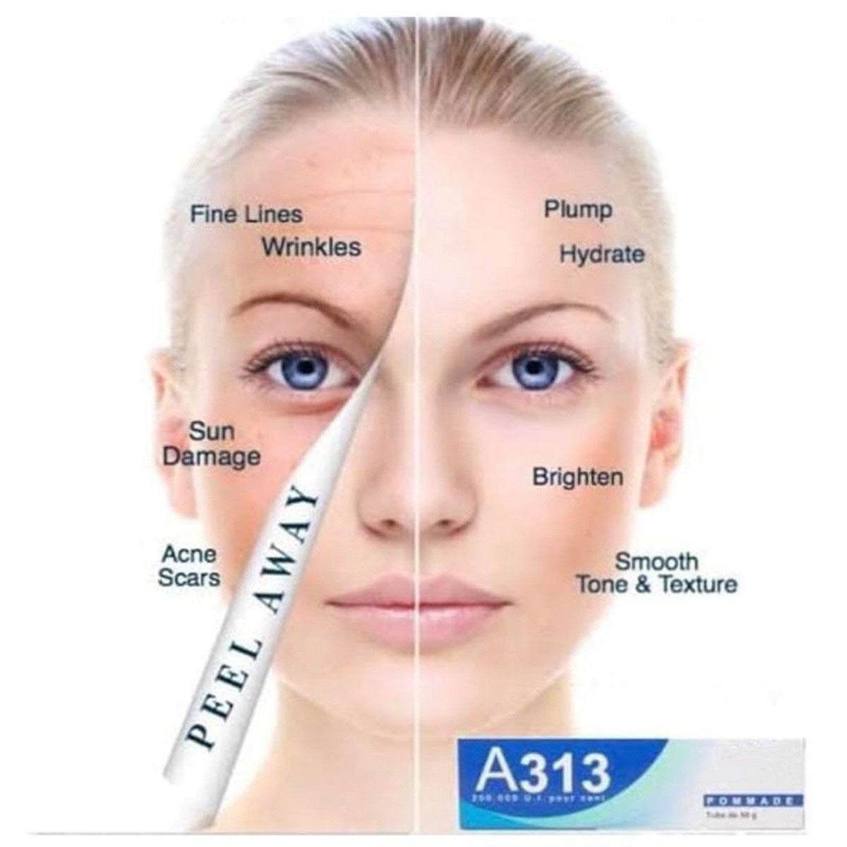 Retinol Vitamin A Cream